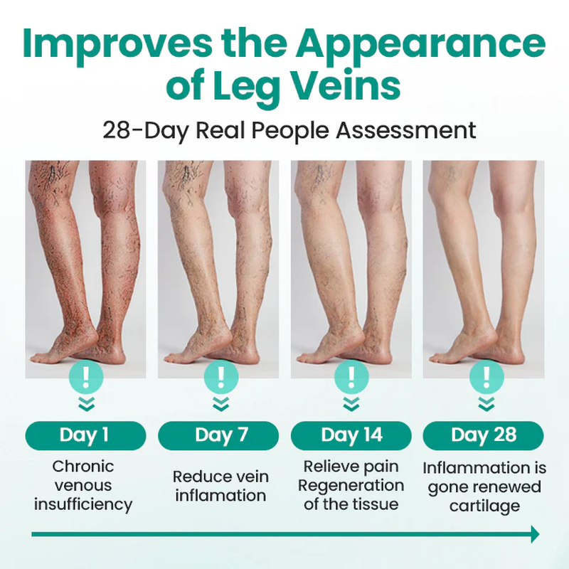 TMRelieve® Legrenew Varicose Veins Patch